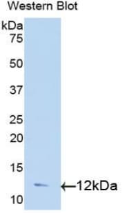 TGFA / TGF Alpha Antibody (aa24-98)
