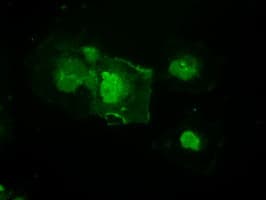 Monoclonal Mouse anti-Human MAP2K4 / MKK4 Antibody (clone OTI2E4, IHC, IF, WB)