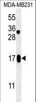 SMIM14 / C4orf34 Antibody (aa56-84)