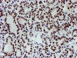 SNAI2 / SLUG Antibody (clone OTI1A6)