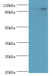 R1 / RRM1 Antibody (aa1-792)