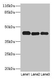 Polyclonal Rabbit anti-Human PME-1 / PPME1 Antibody (IHC, WB)
