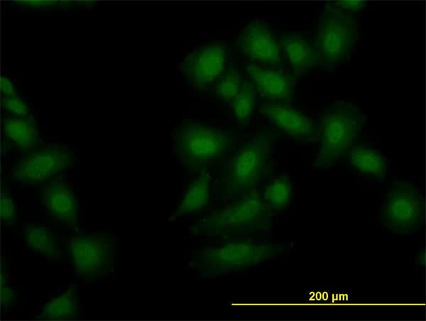 Monoclonal Mouse anti-Human OXSR1 / OSR1 Antibody (clone 1B9, IHC, IF, WB)