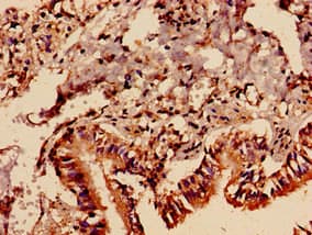 Polyclonal Rabbit anti-Human PREX1 / P-REX1 Antibody (IHC, IF)