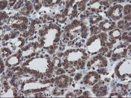 Monoclonal Mouse anti-Human SKIL / SNO / SnoN Antibody (clone OTI3E2, IHC, WB)
