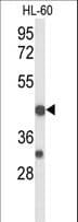 TRAIL-R4 / DCR2 Antibody (aa252-278)
