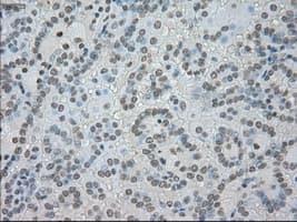 SATB1 Antibody (clone OTI13D6)