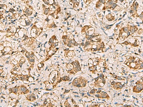 VTA1 Antibody
