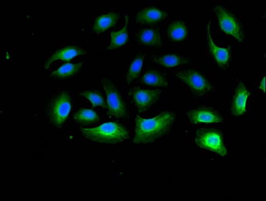 Polyclonal Rabbit anti-Human RPL13A Antibody (IF)