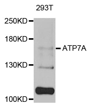 MNK / ATP7A Antibody