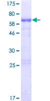 Human NHLRC2 Protein (Recombinant GST)