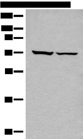 Polyclonal Rabbit anti-Human DDX59 Antibody (IHC, WB)