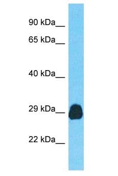 CDV3 Antibody (aa60-109)