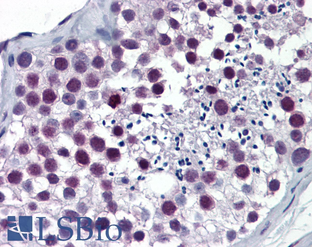 IHC-plus™ Monoclonal Mouse anti-Human ARNT / HIF-1-Beta Antibody (clone 3D10, IHC, IF, WB)