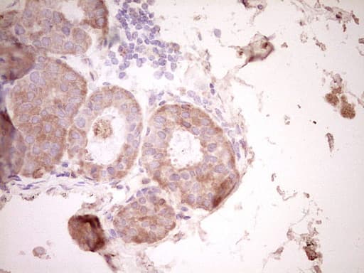 SPP1 / Osteopontin Antibody (aa17-314, clone OTI5E4)