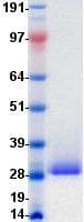 Human HAVCR2 / TIM-3 Protein (Recombinant DDK (Flag)-His, C-terminus)