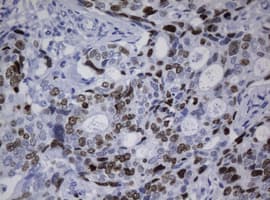 MKI67 / Ki67 Antibody (clone OTI5B10)