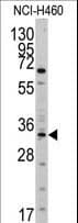 Polyclonal Rabbit anti-Human YBX1 / YB1 Antibody (aa58-87, WB)