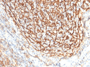 CR2 / CD21 Antibody (clone CR2/2754)