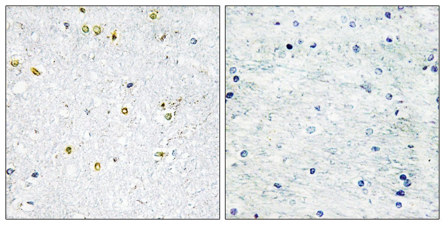 Polyclonal Rabbit anti-Human TRIM24 / TIF1 Antibody (IHC, WB)