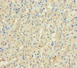 Polyclonal Rabbit anti-Human C12orf49 Antibody (aa34-205)