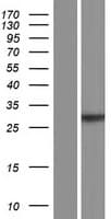 PNPLA4 Protein (Over-Expression Lysate Myc-DDK (Flag))
