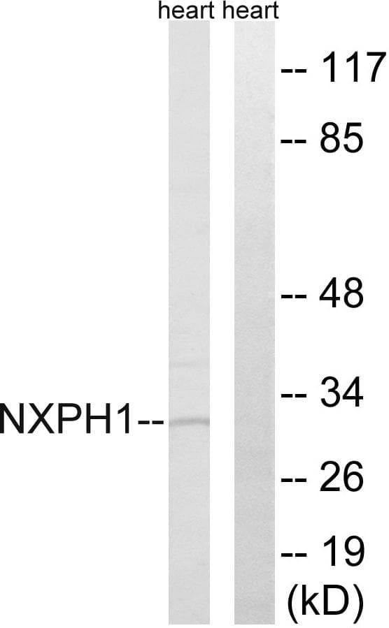Polyclonal Rabbit anti-Human NXPH1 Antibody (IHC, WB)