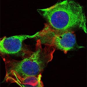 Monoclonal Mouse anti-Human SYN / FYN Antibody (clone 2A10, IHC, IF, WB)