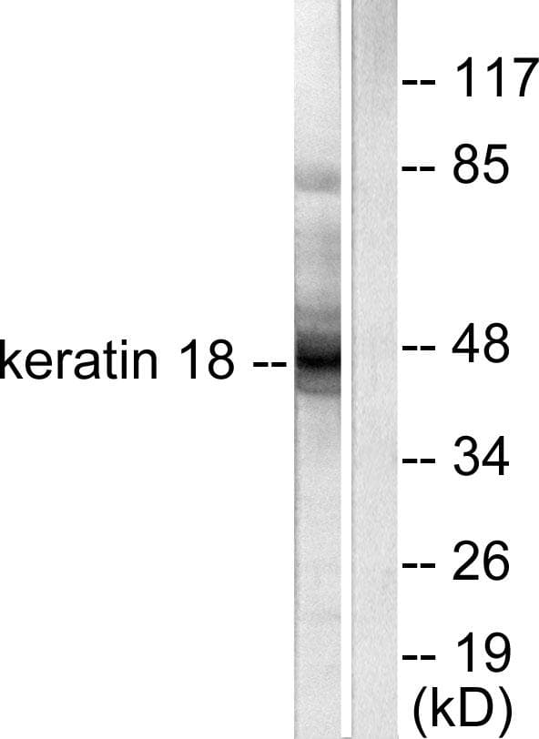 KRT18 / CK18 / Cytokeratin 18 Antibody