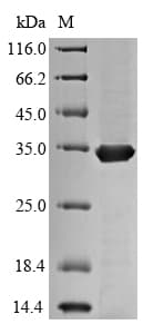 Mycobacterium tuberculosis fbpC Protein (Recombinant 6His, N-terminus)
