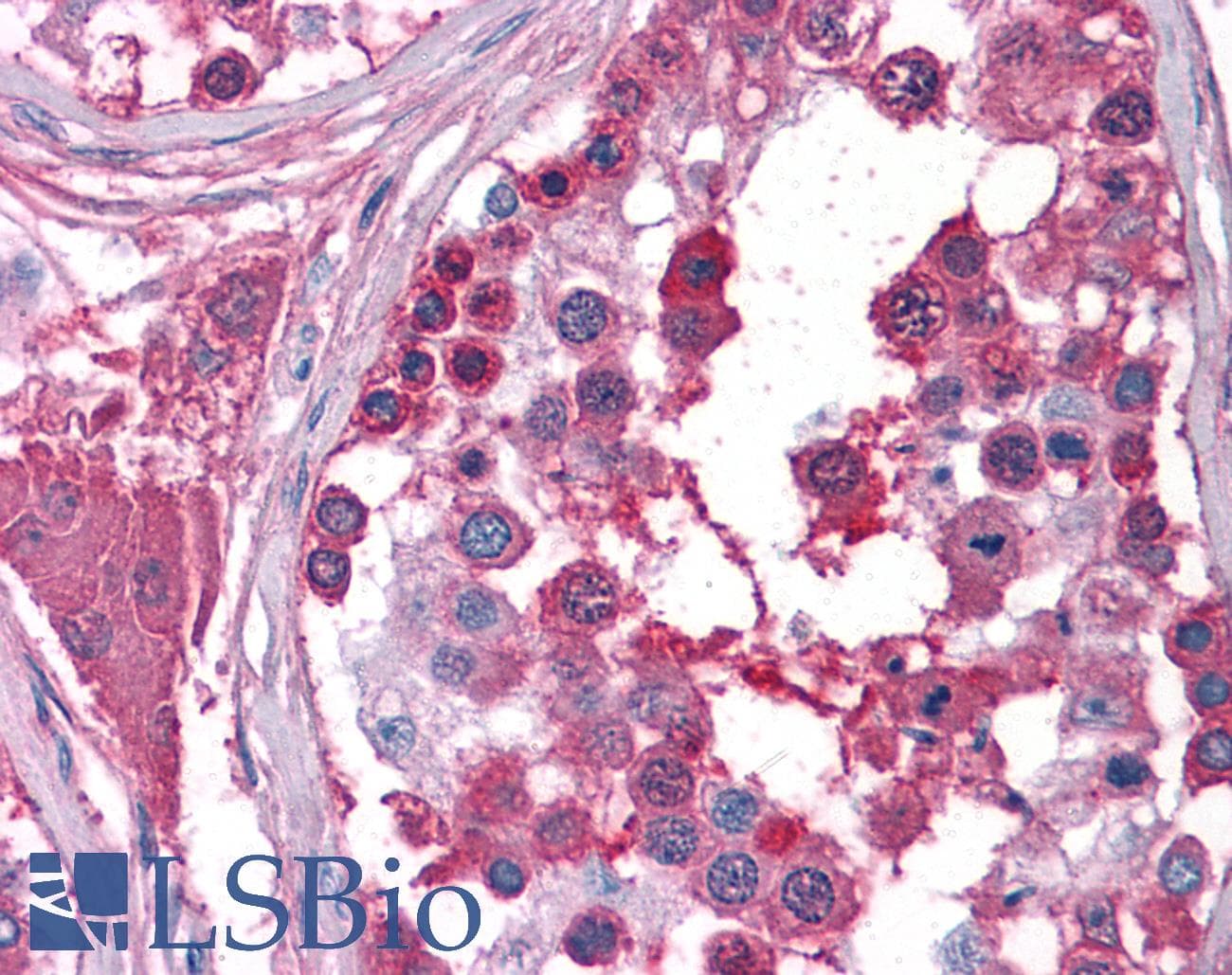 IHC-plus™ BUB3 Antibody
