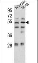 PA26 / SESN1 Antibody (aa312-341)