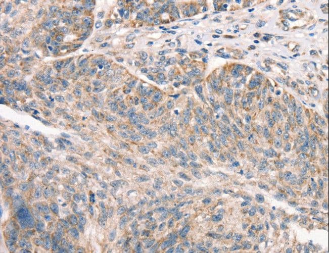 DECR1 Antibody