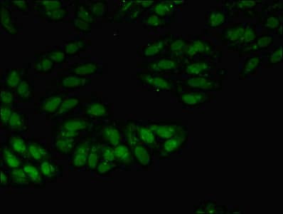 Polyclonal Rabbit anti-Human SNRPA / U1A Antibody (IHC, WB)