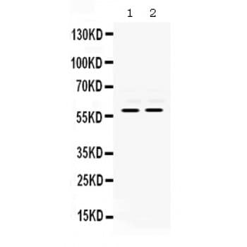 MMP8 Antibody (aa119-153)