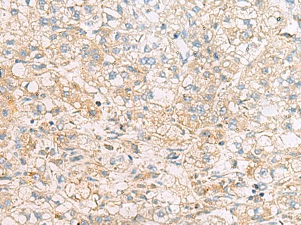 EIF4E2 / IF4e Antibody