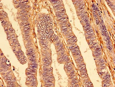 Polyclonal Rabbit anti-Human TNFRSF10A / DR4 Antibody (IHC, IF, WB)