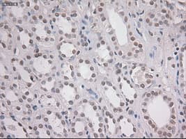 NOTCH1 Antibody (clone OTI4C9)