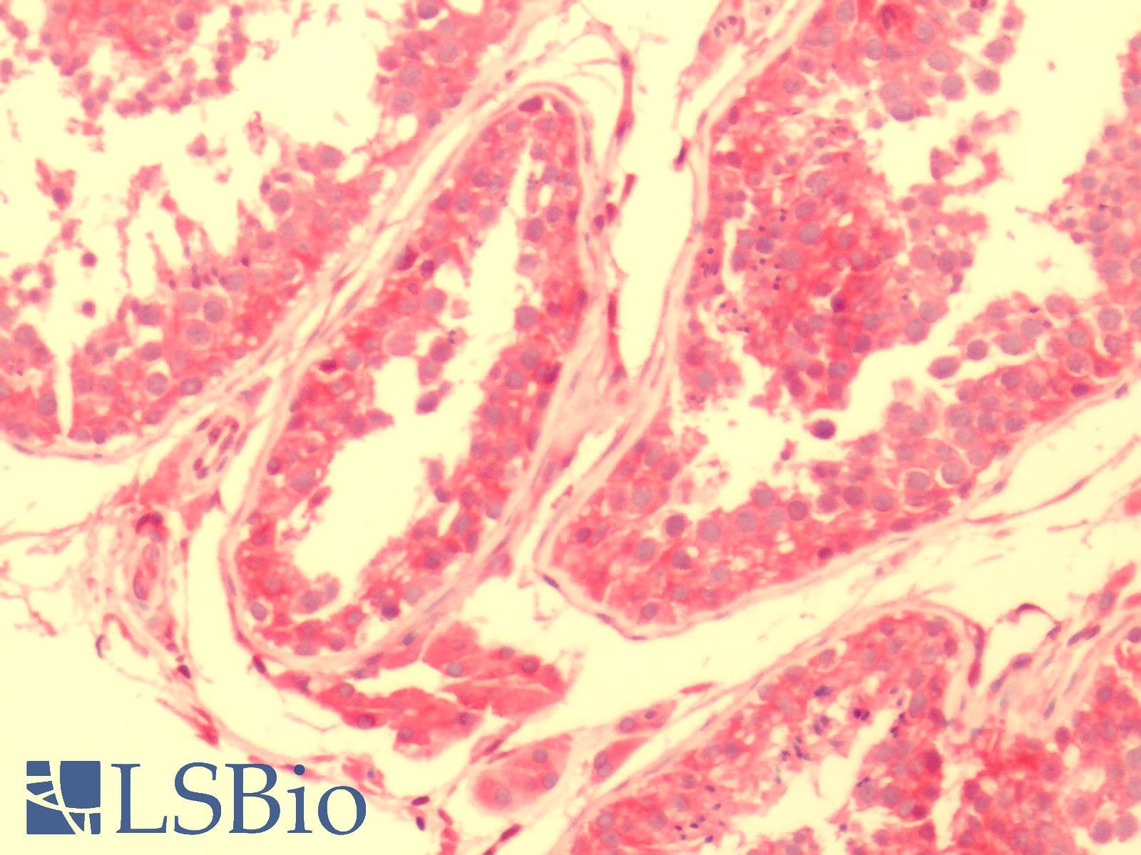 IHC-plus™ NPY2R Antibody (C-Terminus)