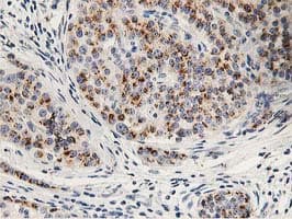 HOXC11 Antibody (clone OTI2A10)