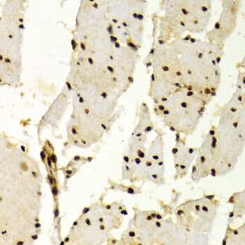 QIP1 / KPNA4 Antibody