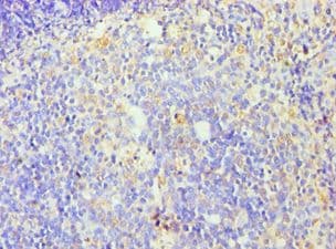 ZNF346 Antibody (aa1-294)