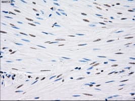 SORD / Sorbitol Dehydrogenase Antibody (clone OTI12A7)