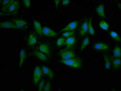 MT3 / Metallothionein 3 Antibody