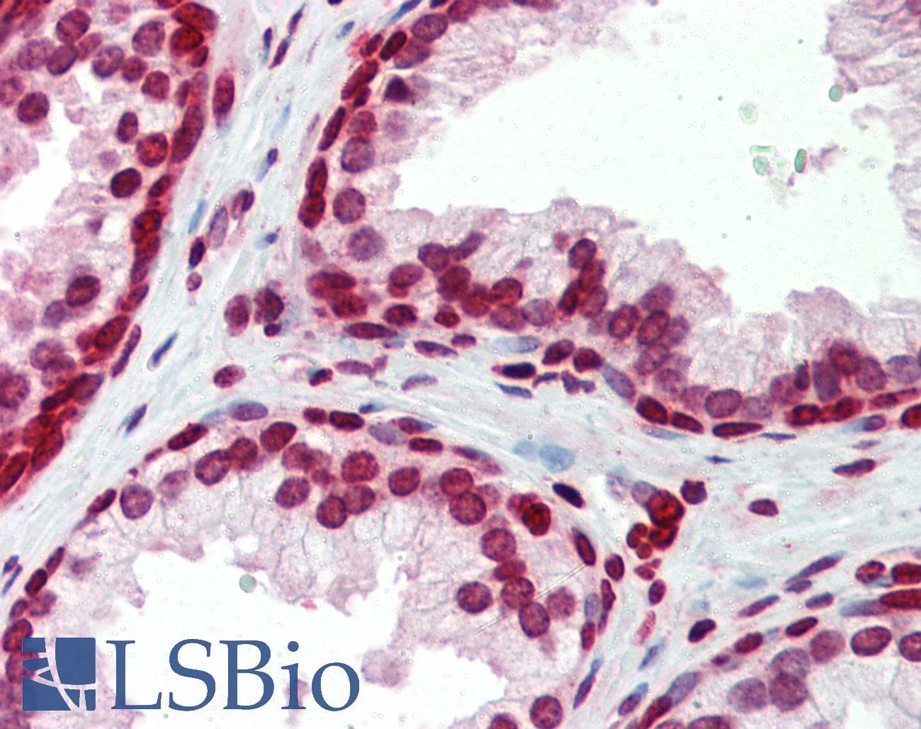 Polyclonal Rabbit anti-Human BXDC5 / RPF1 Antibody (aa45-94, IHC, WB)