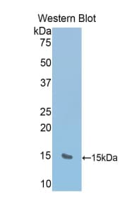 RIP1 / RALBP1 Antibody (aa527-626, Biotin)