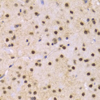 SNRPE Antibody