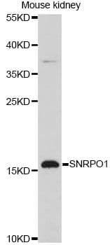 SNRPD1 / SMD1 Antibody