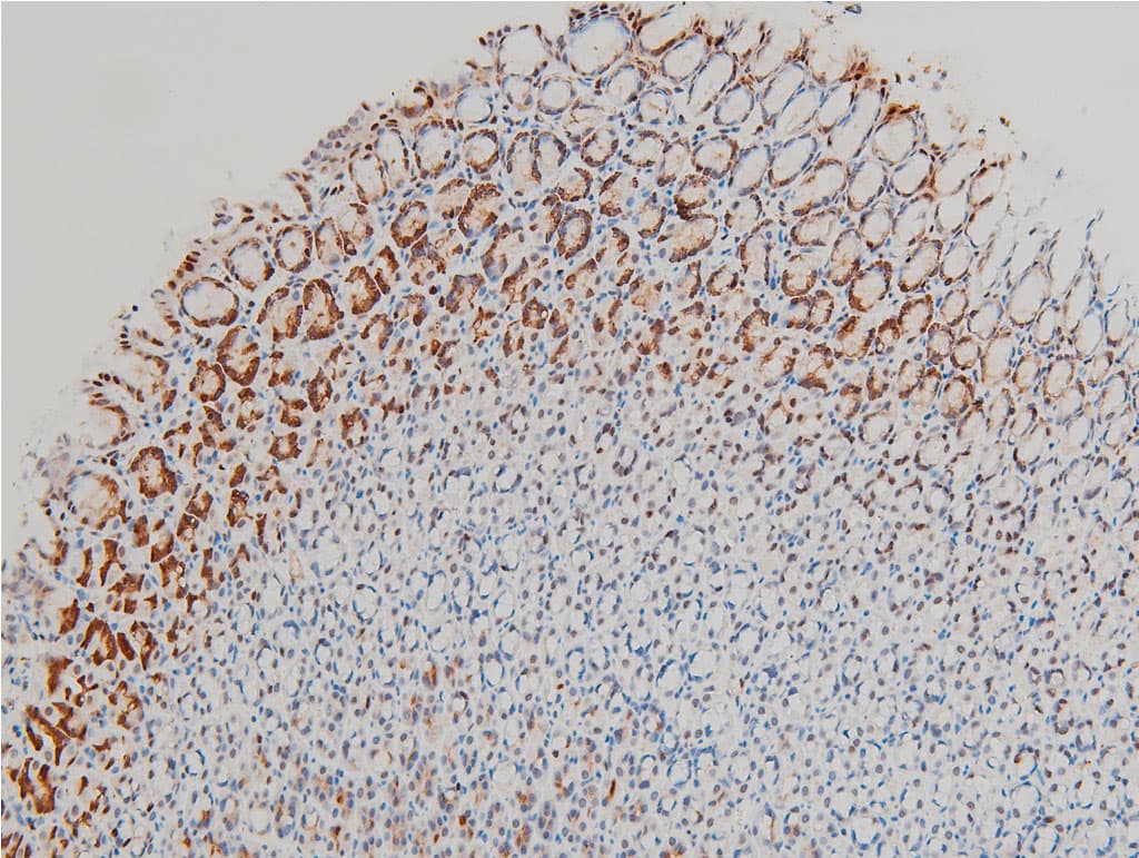 CFL1 / Cofilin Antibody (phospho-Ser3)