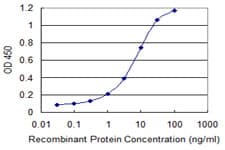 QDPR / DHPR Antibody (clone 2D4-1D3)